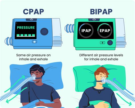 Can A Cpap Machine Cause A Headache at Tiffany Lehmann blog