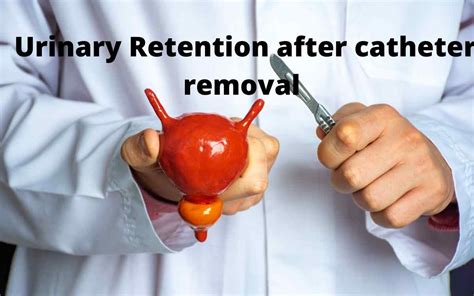 Urinary Retention After Catheter Removal Female: What You Need To Know