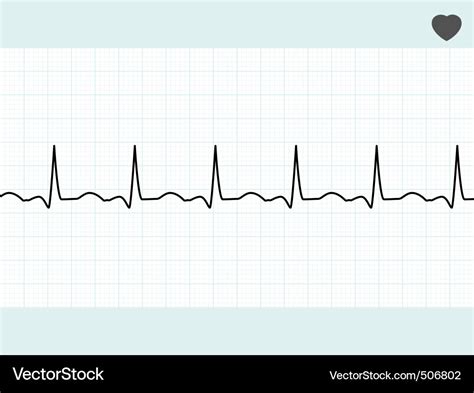 Normal electrocardiogram ecg eps 8 Royalty Free Vector Image