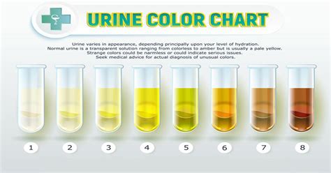 What Can The Color Of Urine Say About Your Health?