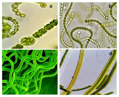 Cyanobacteria: (a) Anabaena planctonica; (b) Nostoc commune; (c ...