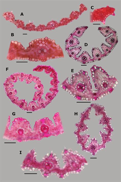 Leaf blade anatomy in transversal section of Agrostis species, in ...