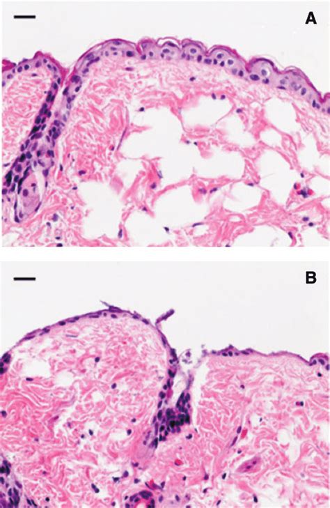 Hematoxylin and eosin (H&E) stained histology of representative BALB/c... | Download Scientific ...