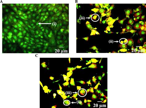 The morphological changes of untreated and treated MCF7 cells stained ...