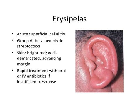 Infections of the external ear