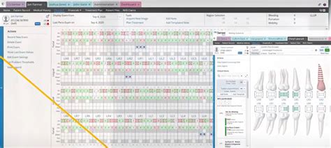 Carestream Dental EMR Software | Latest Reviews, Pricing & Demo ...