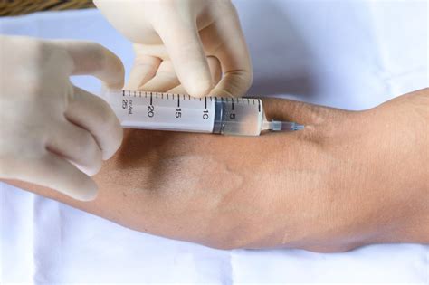 Facts about Intravenous Injection administration | veinscny.com