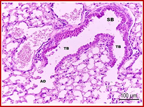 Histological Characteristics of the Tracheobronchial Tree of the Least Shrew (Cryptotis Parva ...