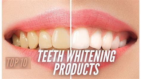 Top 10 Teeth Whitening Products For Pearly White Teeth - Superloudmouth