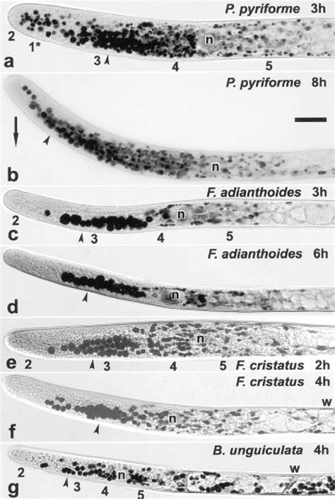 Upward gravitropism and amyloplast sedimentation in horizontally... | Download Scientific Diagram