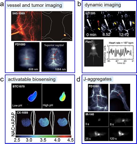 NIR-II fluorescence imaging of vessel and tumor (a), dynamic imaging... | Download Scientific ...