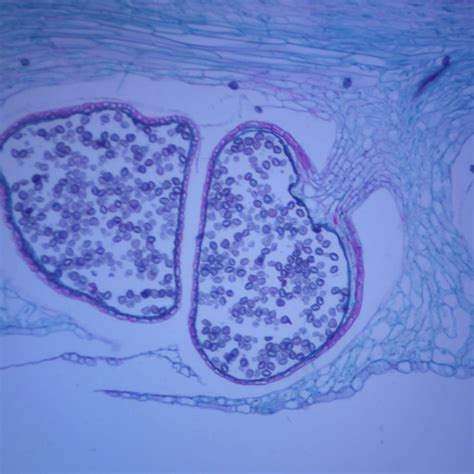 Lycopodium Strobilus, l.s., 12 µm Microscope Slide | Carolina.com