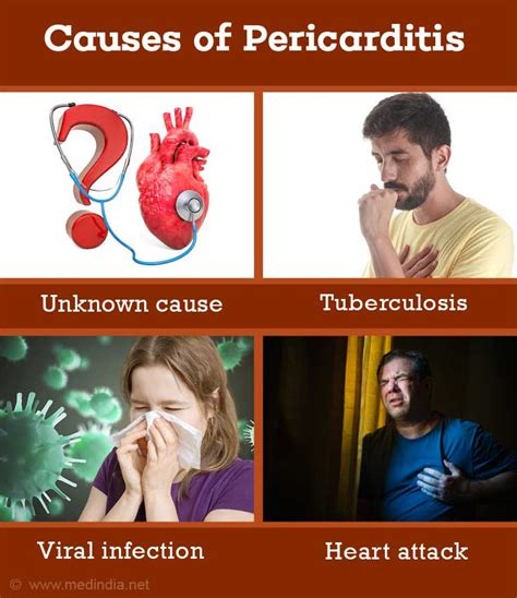 Pericarditis - Causes Symptoms and Signs Diagnosis Treatment