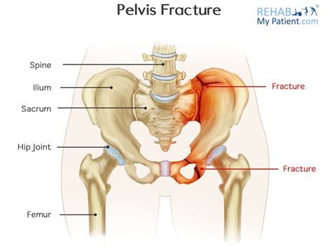 Articles | Rehab My Patient