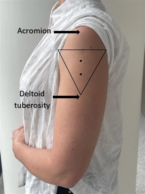 Deltoid Injection Site