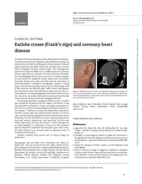 (PDF) Earlobe crease (Frank’s sign) and coronary heart disease | Shah Alam Sharif - Academia.edu