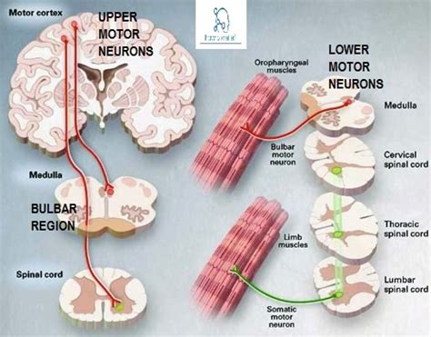 Upper Motor vs. Lower Motor Neuron Disease » How To Relief