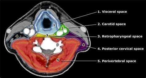 Giải Phẫu CT & MRI Vùng Cổ