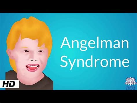 Angelman-syndroom: oorzaken, symptomen en behandeling - Psychologie - 2024