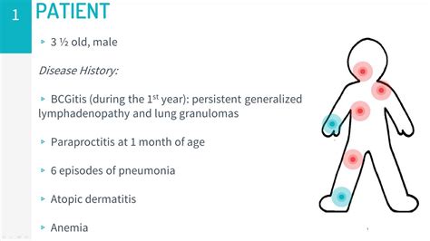 Chronic granulomatous disease (CGD) - YouTube