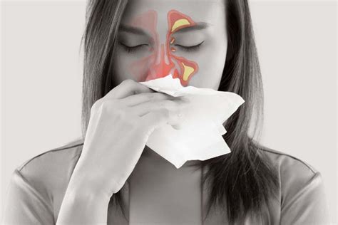 Sinus Headaches | Symptoms, Causes, and Treatment - Pure Medical