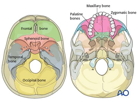 Skull base fracture, posterior