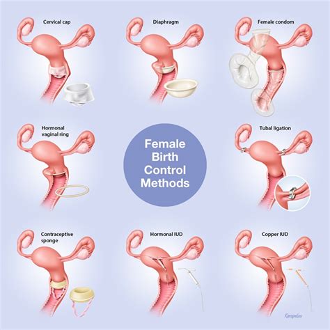 Nuvaring Insertion Diagram