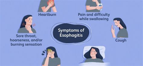 Esophagitis – causes, symptoms. What types of esophagitis are there ...