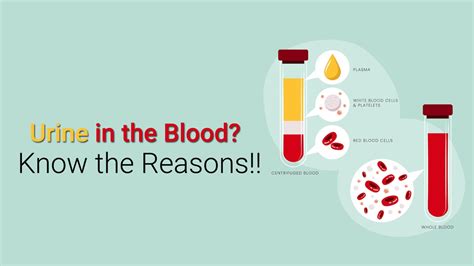 Causes of Hematuria | Treatment for Hematuria