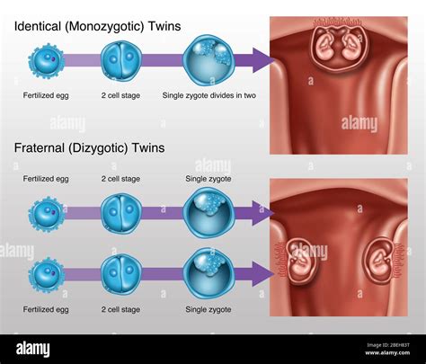 Development of Twins, Illustration Stock Photo - Alamy