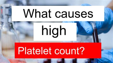 What causes high Platelet count and low TSH 3?