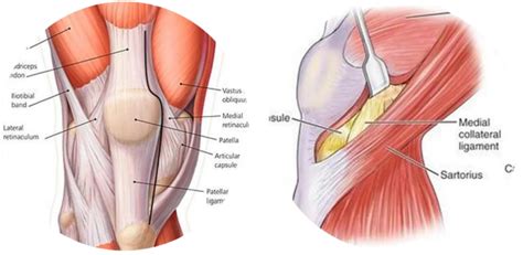 Jiffy Knee | AZ ORTHO | Scottsdale, AZ