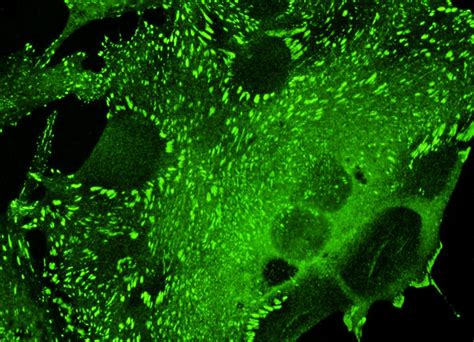 Bovine Pulmonary Artery Cell Vinculin with Cy2 | MicroscopyU