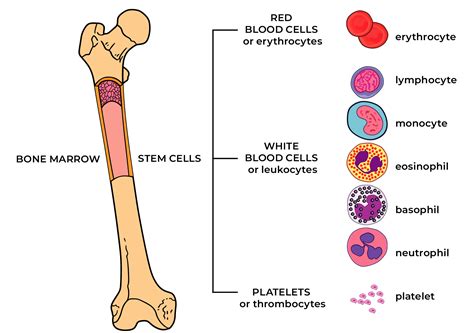 Myelofibrosis