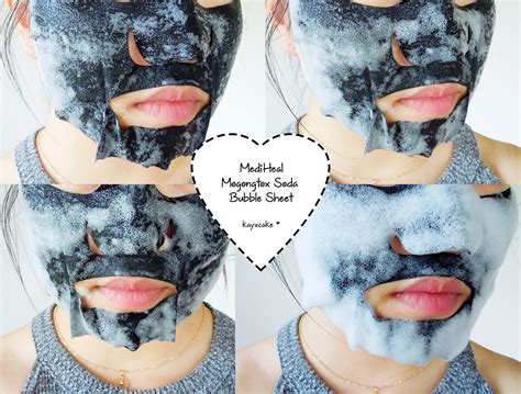 Kay Cake Beauty: Mediheal Mogongtox Soda Bubble Sheet Mask ♡ Review + Before & After Comparison