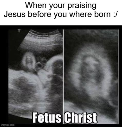 Funny Ultrasound Meme