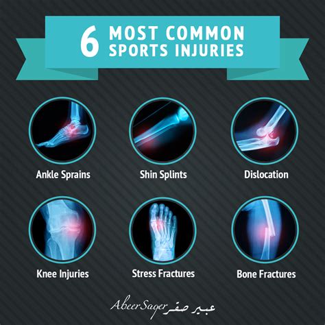 What are the most common sports injuries among athletes? - AbeerSaqer.com