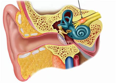 What is vestibular neuritis? - Blog of Kiversal