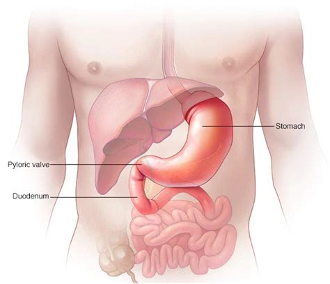 How to Treat Gastroparesis - Dr. Nicholas L. DePace, M.D., F.A.C.C.