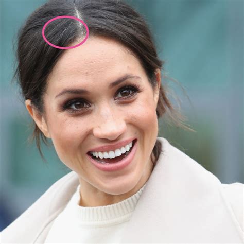 Meghan Markle's Single Grey Hair Causes Twitter Uproar