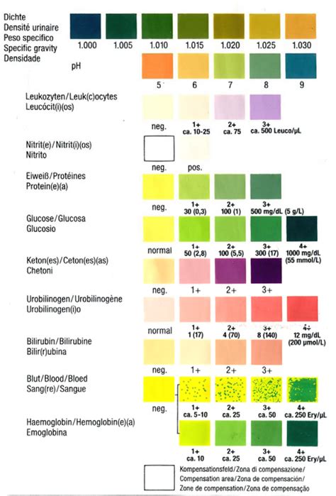 Urine-onderzoek routine - wikilab