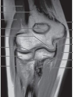 Coronal MRI of the Elbow Diagram | Quizlet