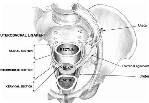 A schematic diagram of the pelvis viewed from above showing the three ...