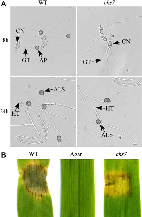 Figure 1 from Differences between appressoria formed by germ tubes and appressorium-like ...