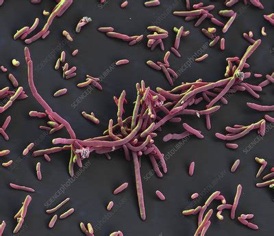 Aeromonas hydrophila bacteria, SEM - Stock Image - C045/9624 - Science ...