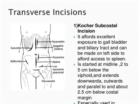 Surgical incisions