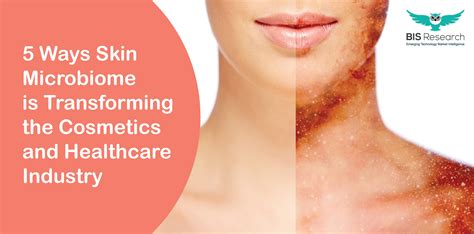 5 Ways Skin Microbiome is Transforming the Cosmetics and Healthcare ...