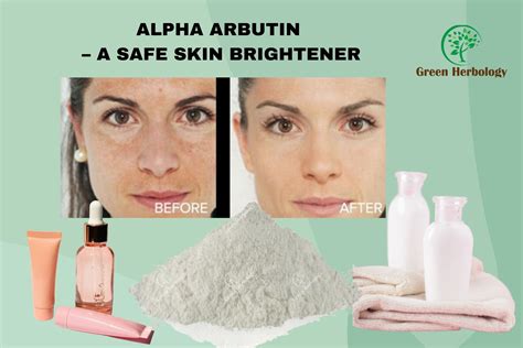 MEET ALPHA ARBUTIN - THE BEST SECRET INGREDIENT FOR SKIN BRIGHTENING ...