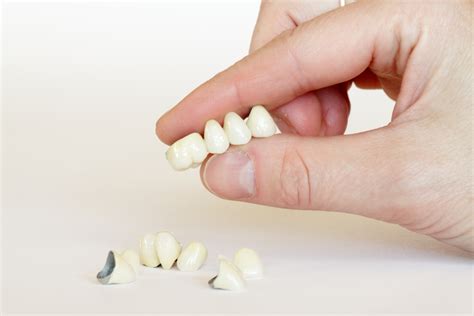 8 Common Dental Crown Problems and Solutions | Hinsdale Dentistry