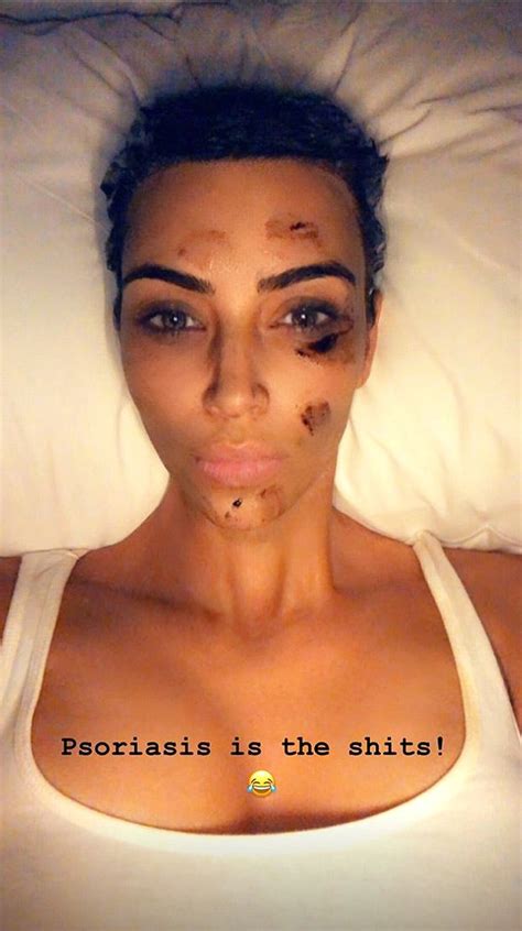 Kim Kardashian Covers Up Her Psoriasis Using New KKW Beauty Body Makeup